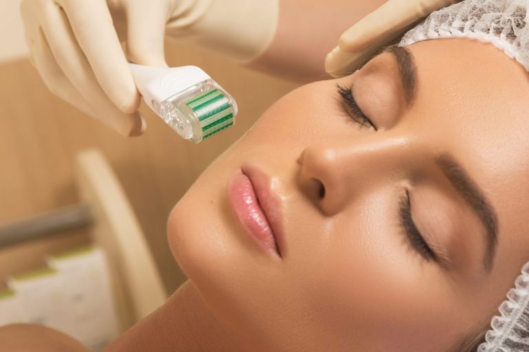 Microneedling