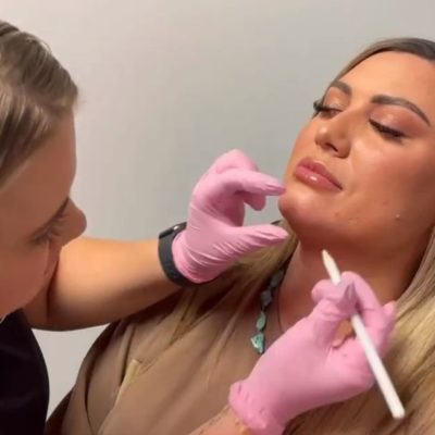 Injector Assessing Patient for Their Filler Treatment | SkinFX Med Spa in Clinton UT