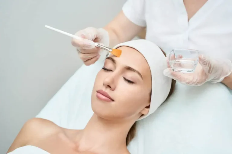 Chemical Peel in Clinton, UT Skinfxutah